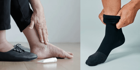 Diabetesstrømper: Hvem bør bruge dem - og hvorfor? - Seniorshop
